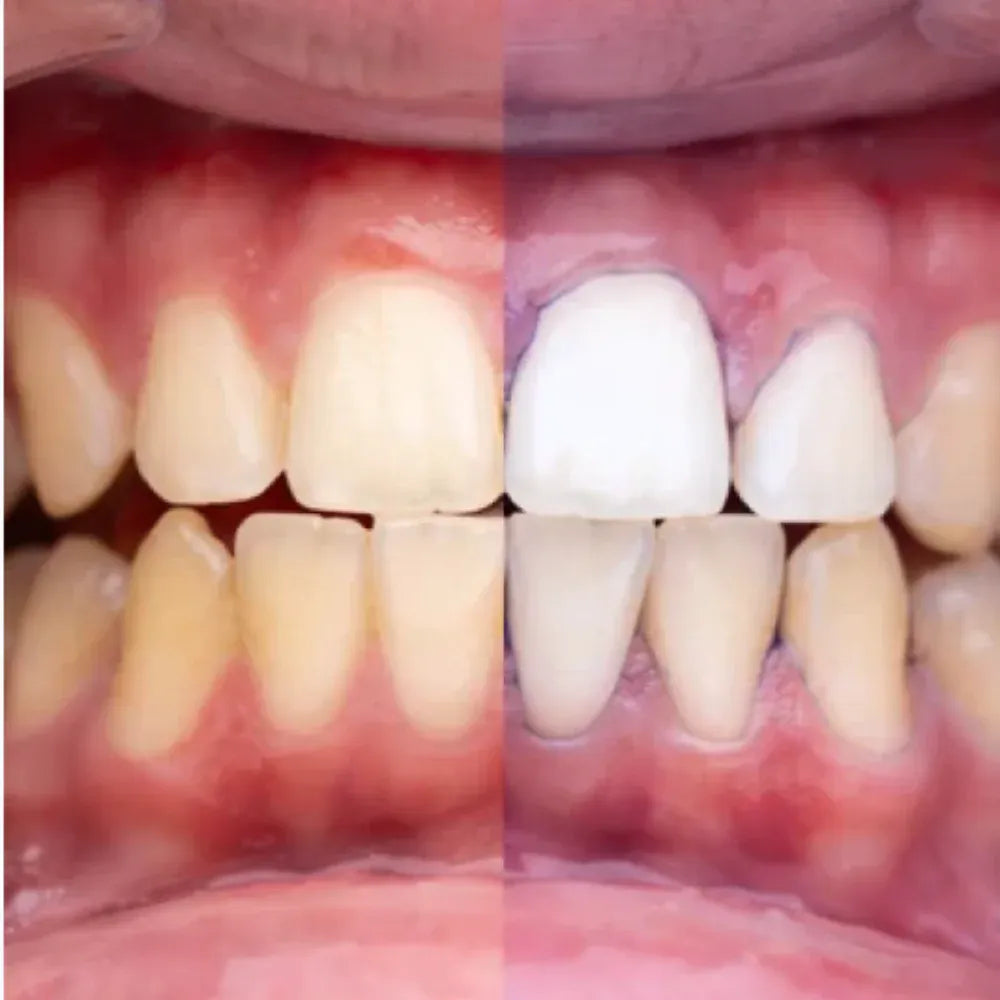 Pasta Dental Blanqueadora V34 | Dientes Más Blancos
