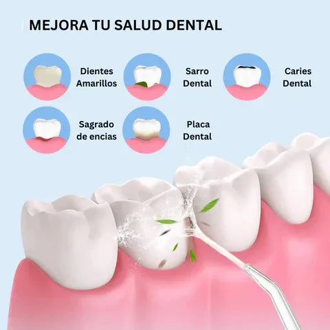 Irrigador Oral Lux – Dientes Más Limpios