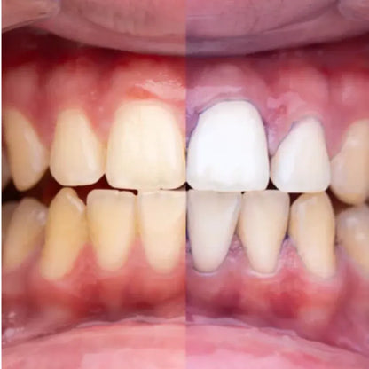 Pasta Dental Blanqueadora V34 | Dientes Más Blancos