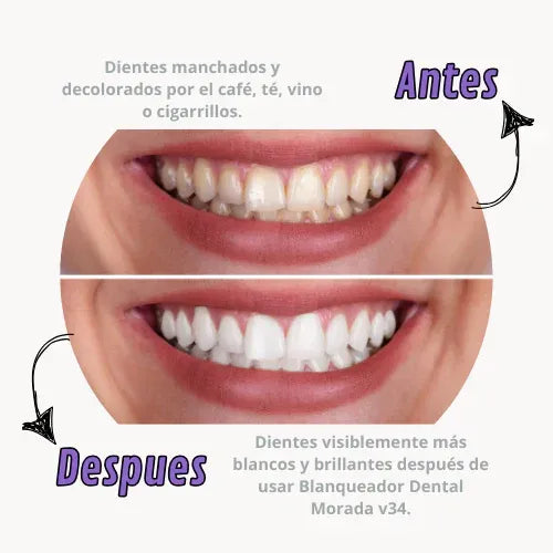 Pasta Dental Blanqueadora V34 | Dientes Más Blancos
